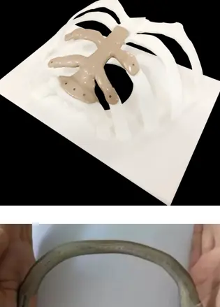 3d printing in medical field