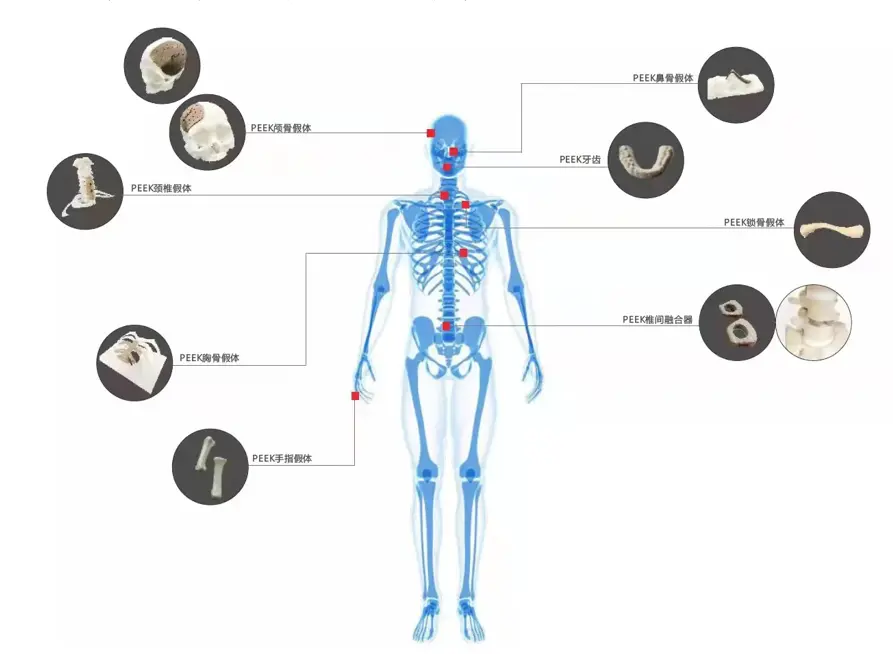 3d printing medical devices