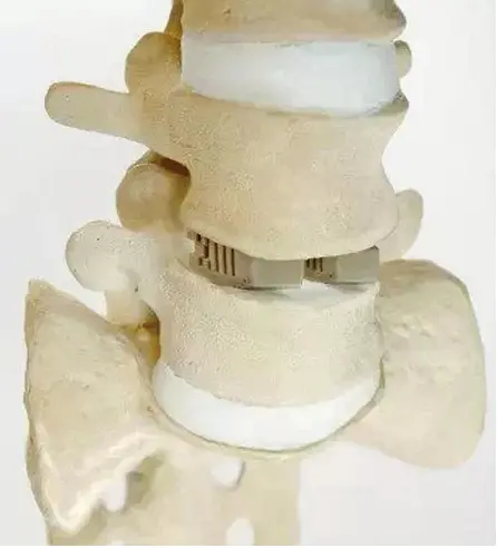 3d printing medical devices