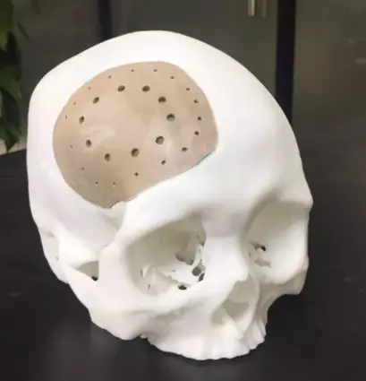 3d printing medical devices
