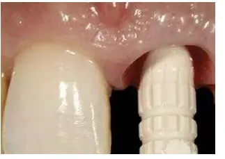 3d printing medical devices