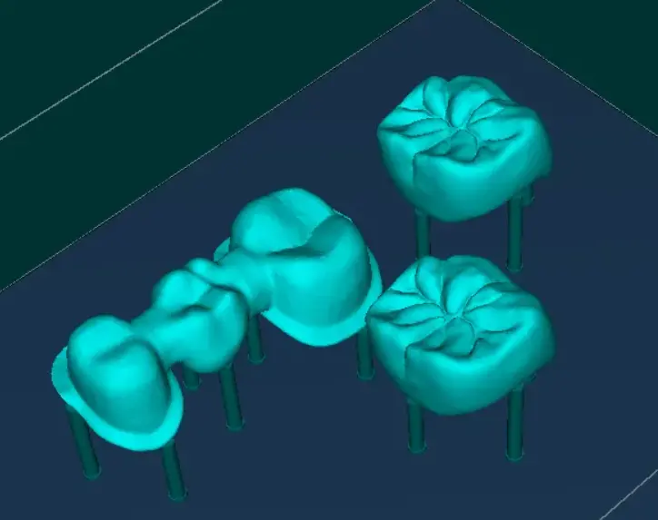 dental 3d printer