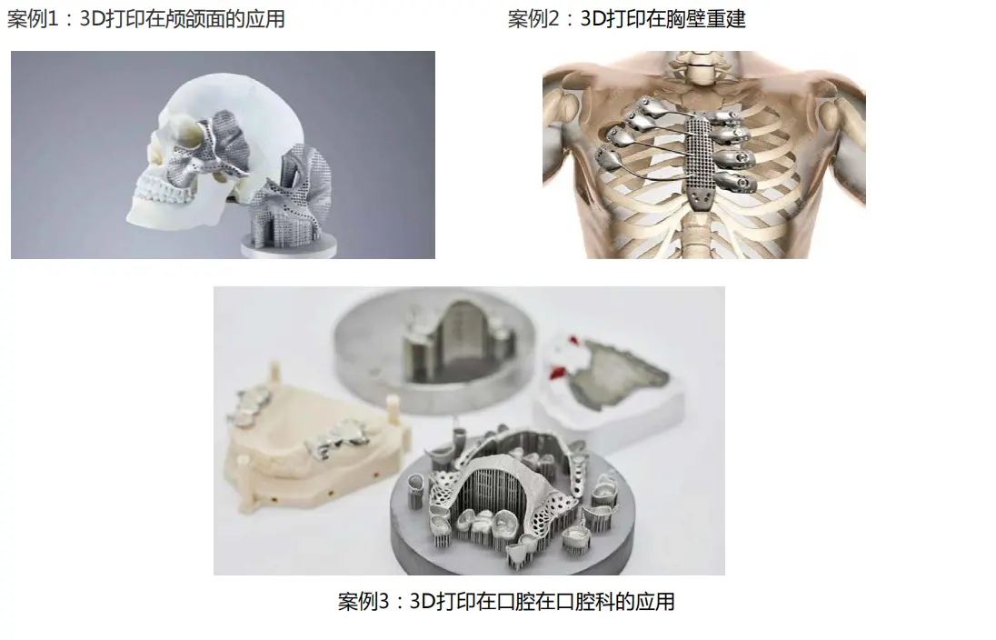 Medical Device Exhibition 